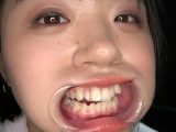 「激カワ人気女優の口内・歯・舌ベロ・のどちんこ観察！！！ 菊池はる